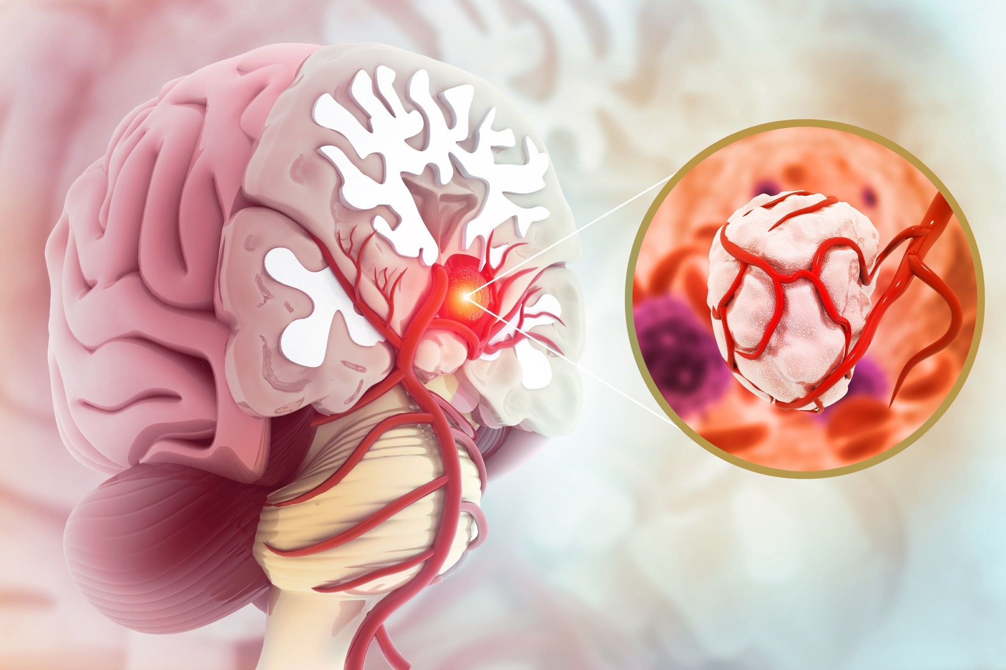 גידולי מוח מנצלים את המקצבים היומיומיים של הגוף כדי לתדלק את הצמיחה