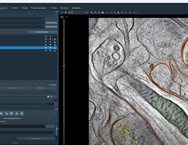 גלה את גירסת התוכנה של Amira 2024.2