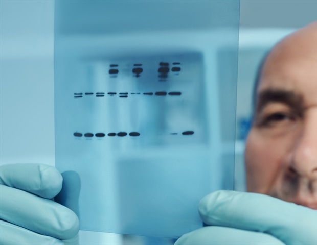 רמות PGE2 גבוהות מניעות שינויים בעור הקשורים לגיל וסיכון לסרטן