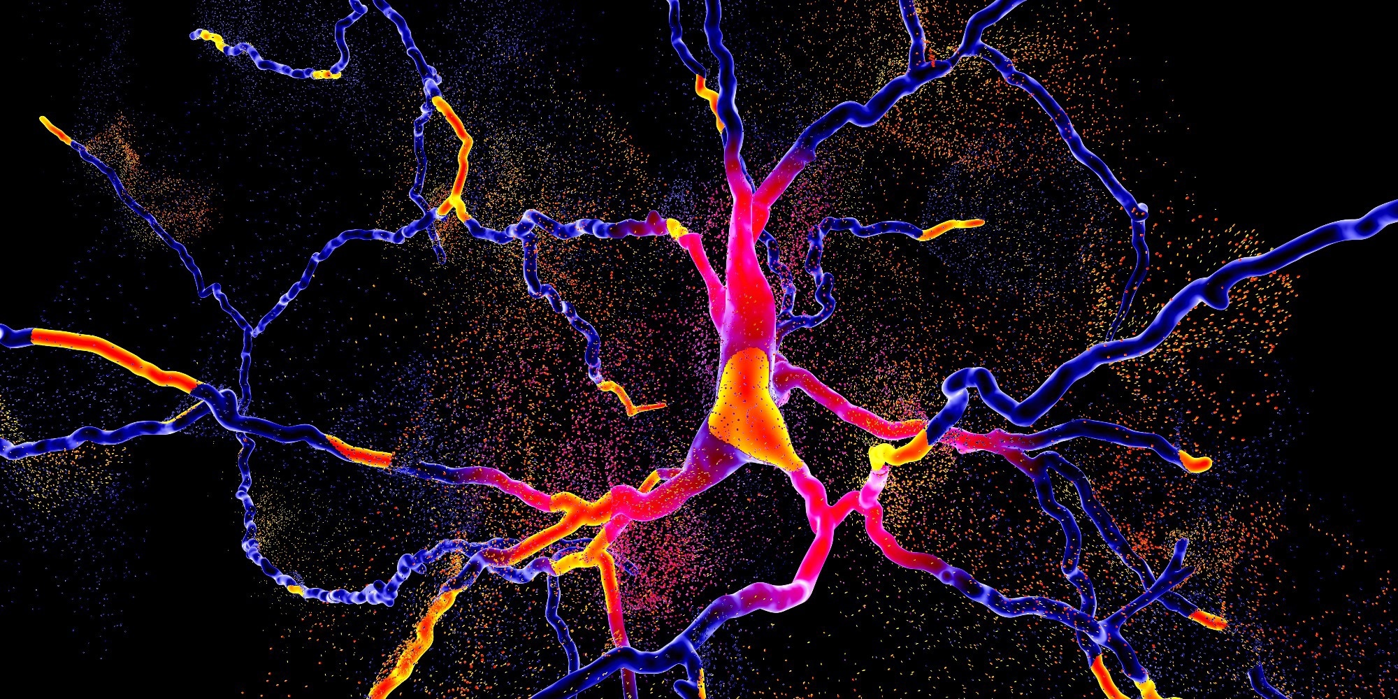 Study: The genetics of neurodegenerative diseases is the genetics of age-related damage clearance failure. Image Credit: Kateryna Kon / Shutterstock