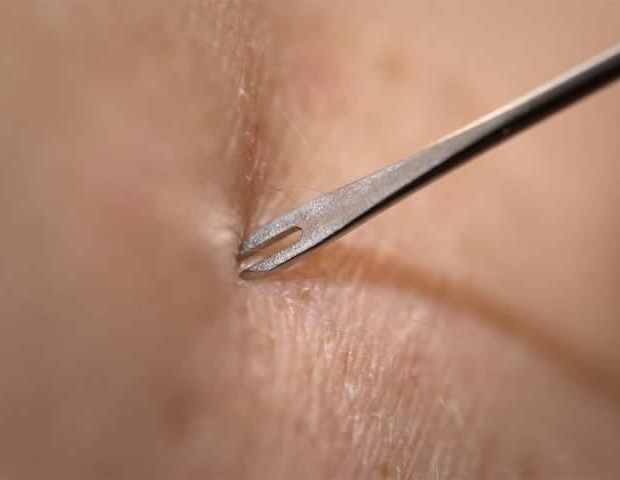 ארגון הבריאות העולמי מצר על החלטתה של ארצות הברית לפרוש מהארגון