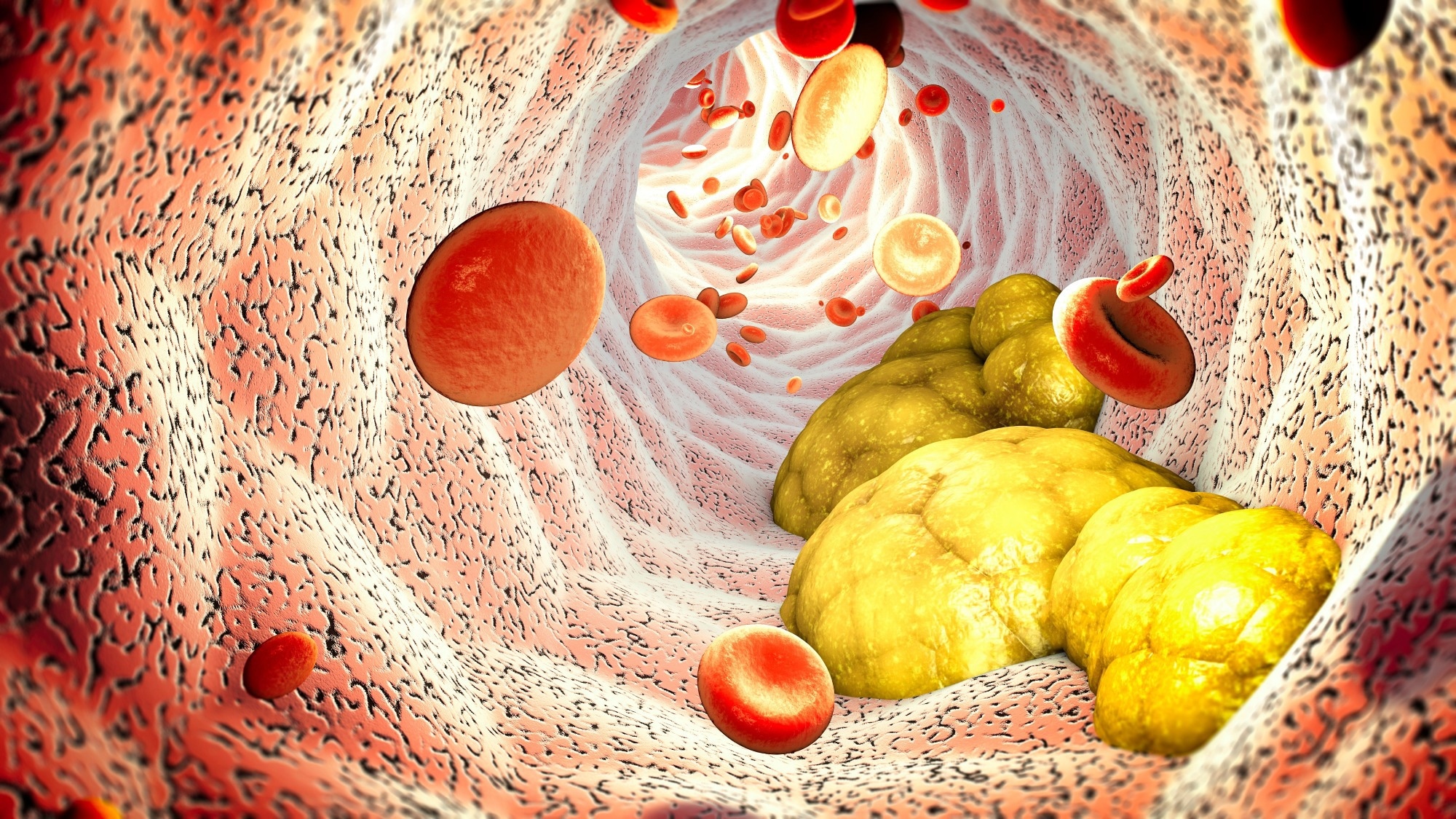 Study: The Cholesterol Paradox in Long-Livers from a Sardinia Longevity Hot Spot (Blue Zone). ​​​​​​​Image Credit: Naeblys / Shutterstock