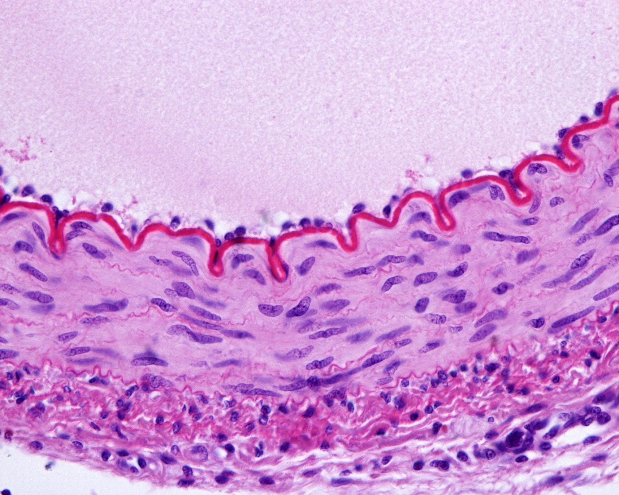 Cross-sectioned muscular artery