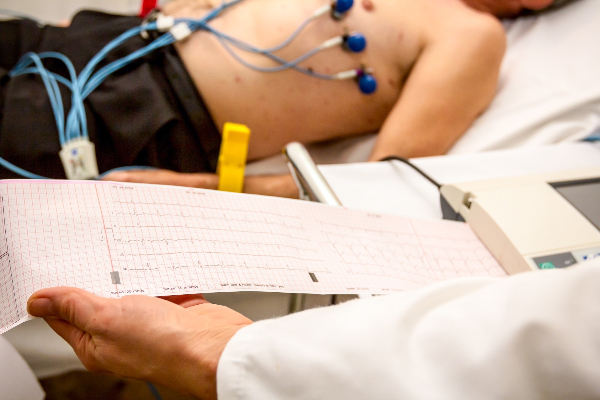 Study: Heart Disease Mortality in the United States, 1970 to 2022. Image Credit: Roman023_photography / Shutterstock