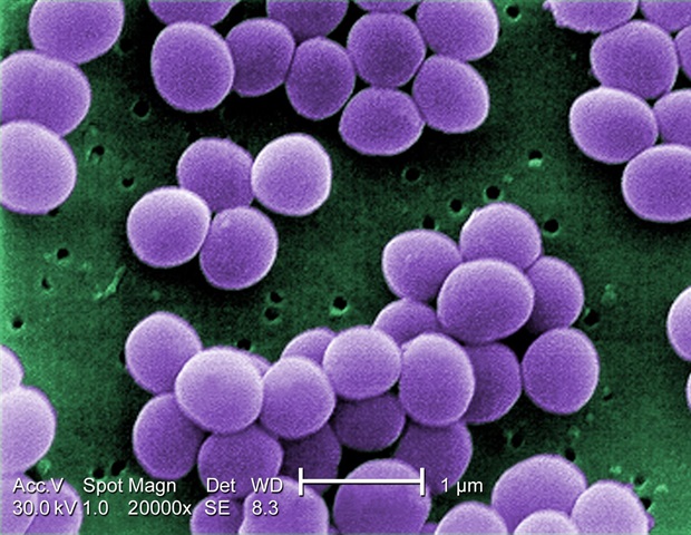 פלטפורמת ננו -חלקיקים חדשה פורצת דרך MRSA Biofilms
