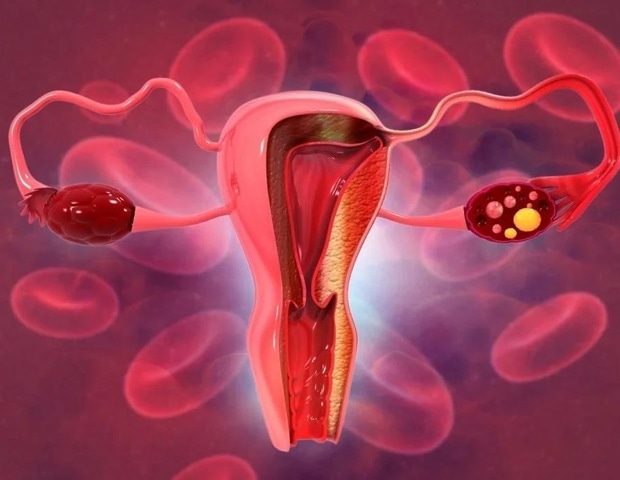 HPV16 ו -18 כמעט הודחו אצל נשים דניות מחוסנות אך סוגי סיכון גבוהים אחרים נמשכים