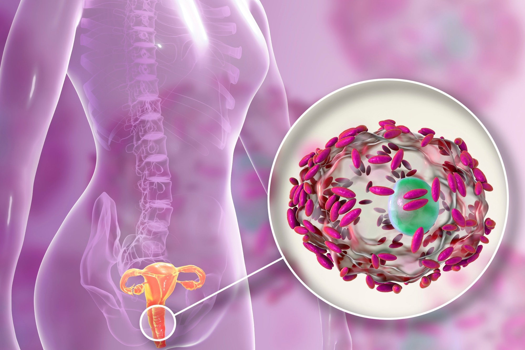 Study: Dietary habits and vaginal environment: can a beneficial impact be expected? Image Credit: Kateryna Kon / Shutterstock