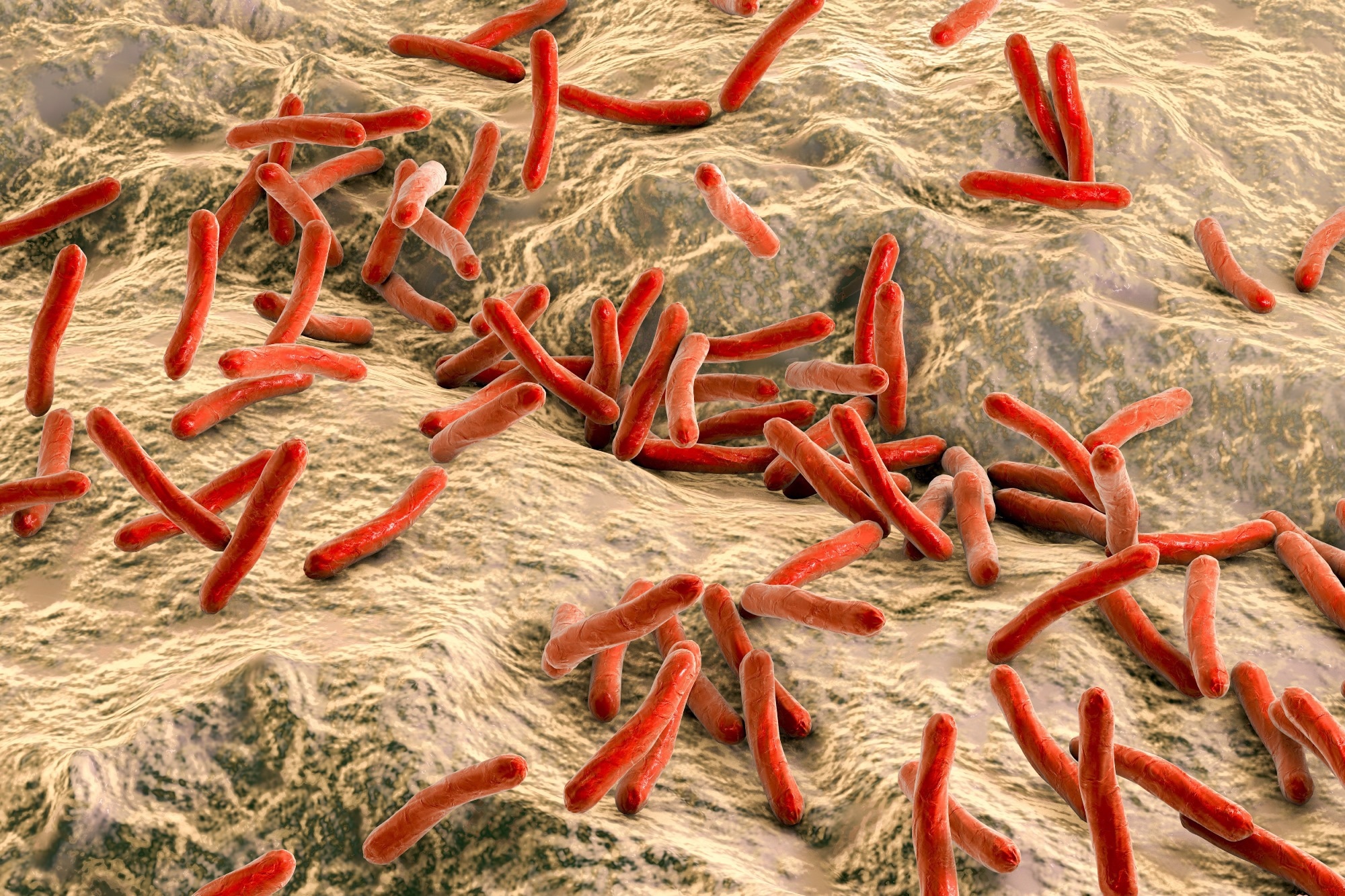 Study: 4,000-year-old Mycobacterium lepromatosis genomes from Chile reveal long establishment of Hansen’s disease in the Americas. Image Credit: Kateryna Kon / Shutterstock