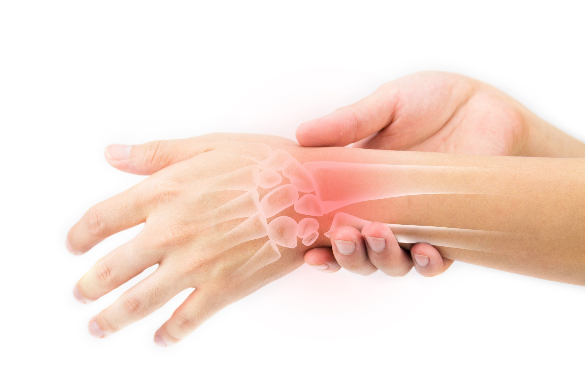 Study: Overuse injury induces persistent behavioral declines that correlate with higher IL-6 expression in the affected musculoskeletal tissues, circulation, and brain. Image Credit: SoftSheep / Shutterstock