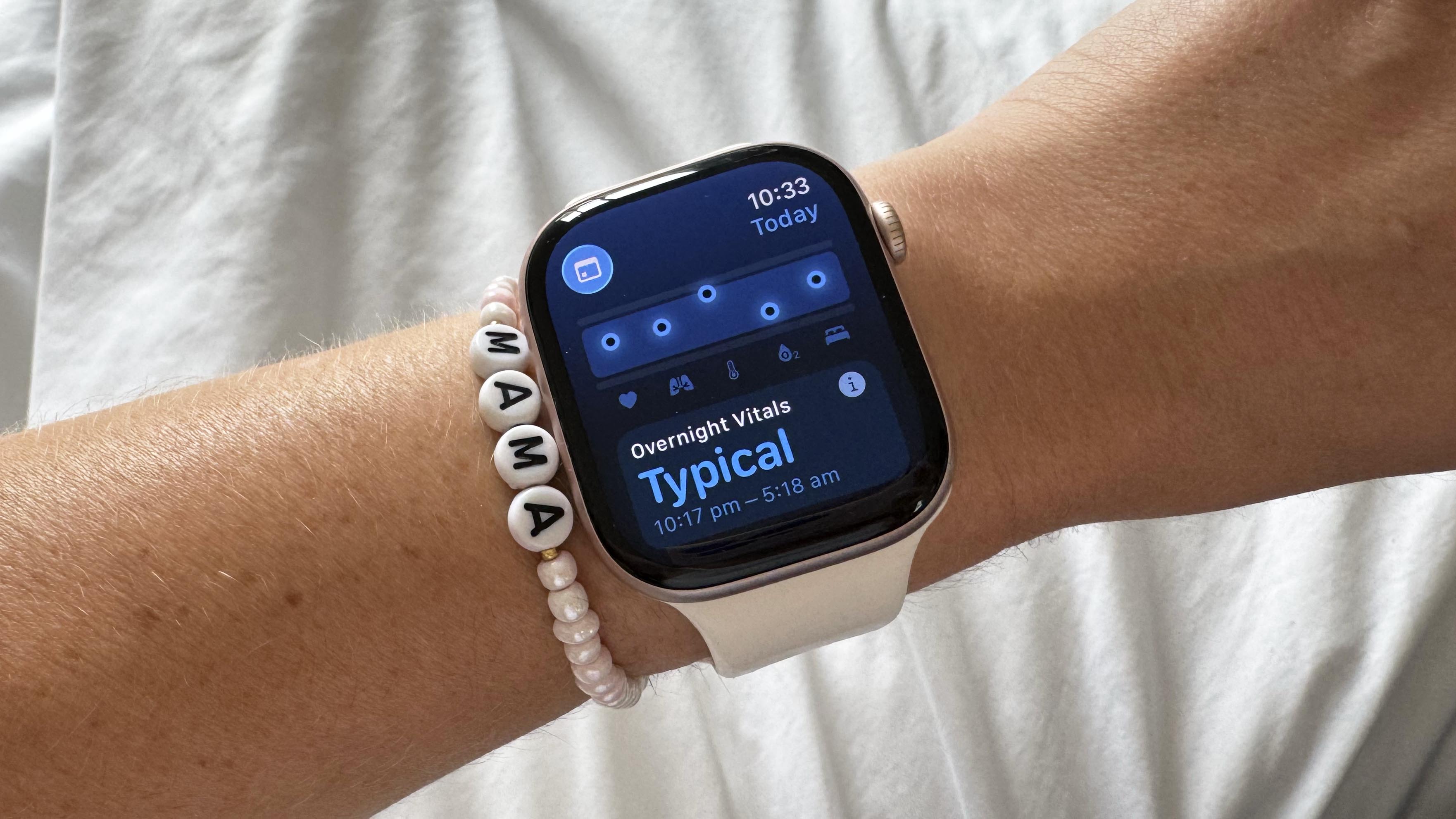אפליקציית Vitals ב- Apple Watch 10