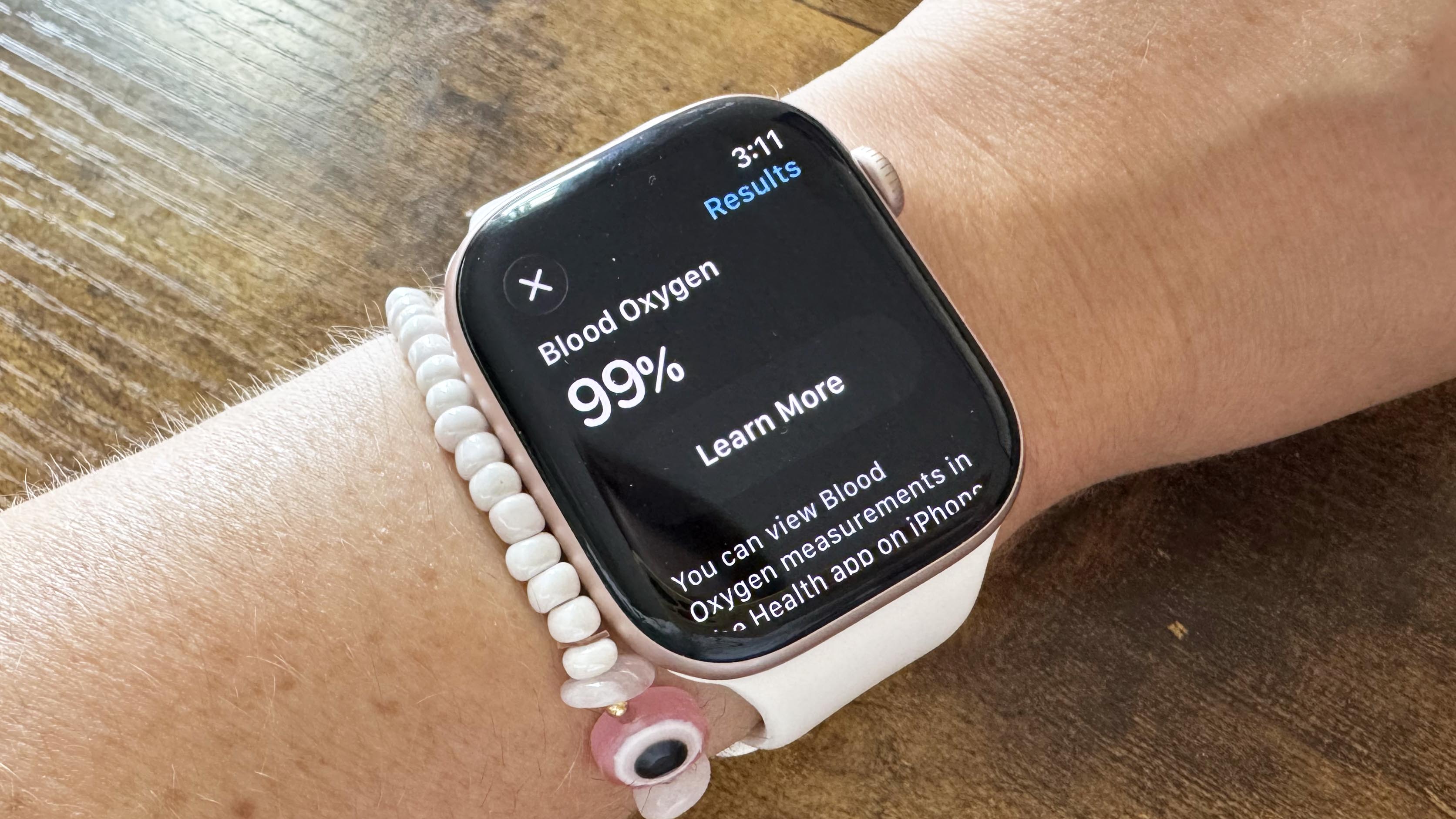 חמצן דם קורא Apple Watch 10
