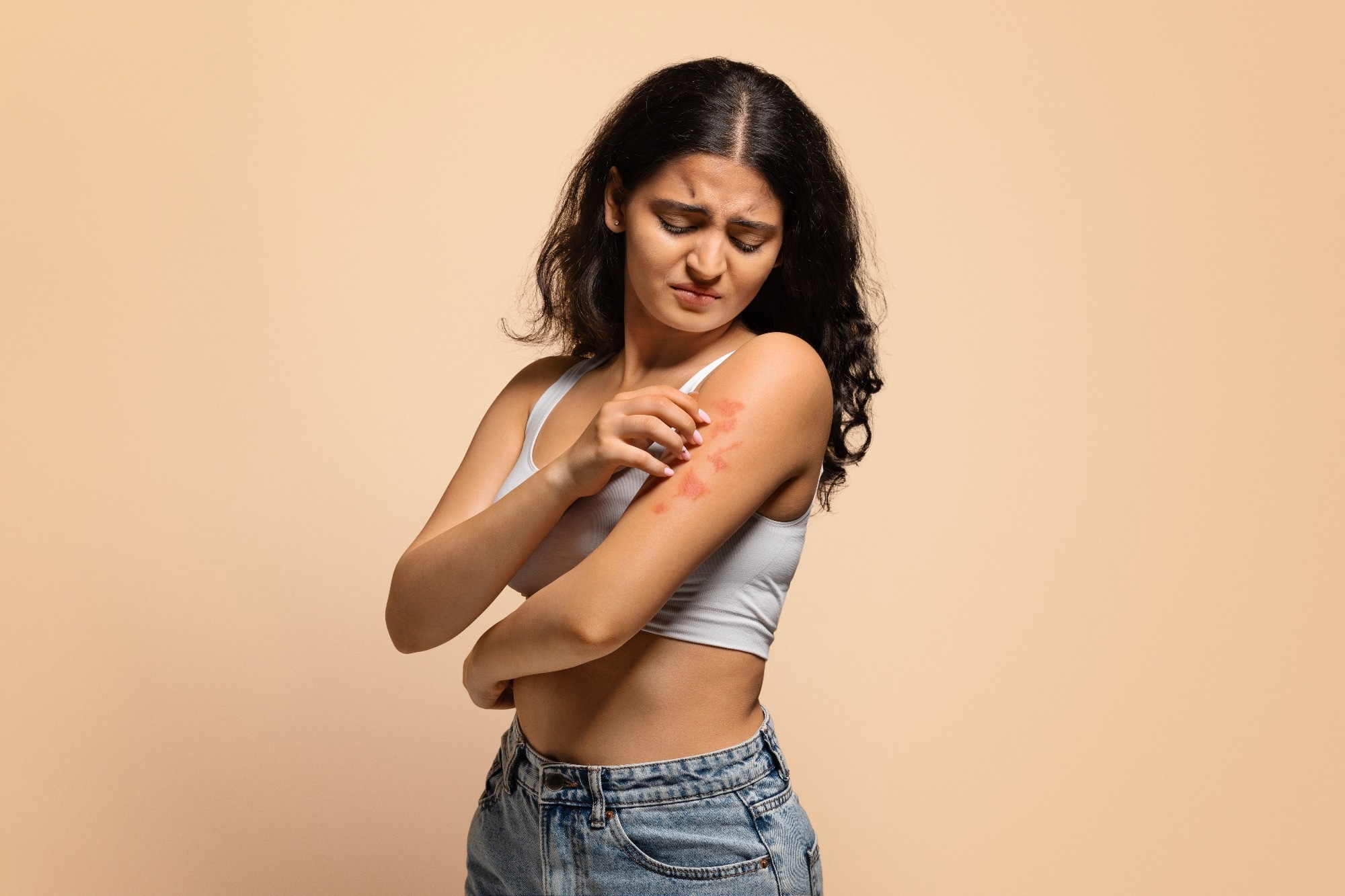 Study: Maternal stress triggers early-life eczema through fetal mast cell programming. Image Credit: Prostock-studio / Shutterstock