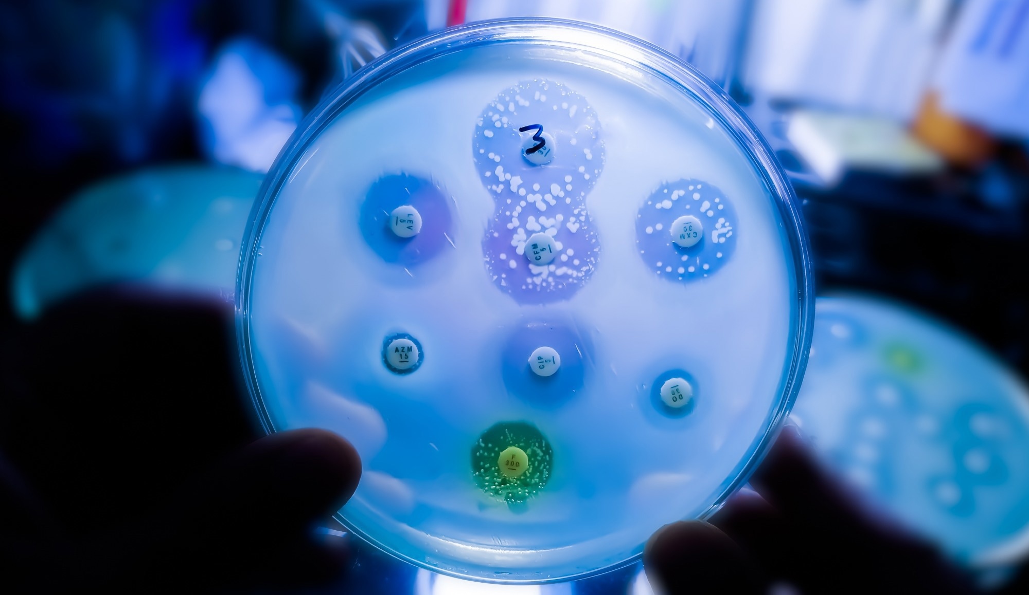Antimicrobial susceptibility testing in petri dish.