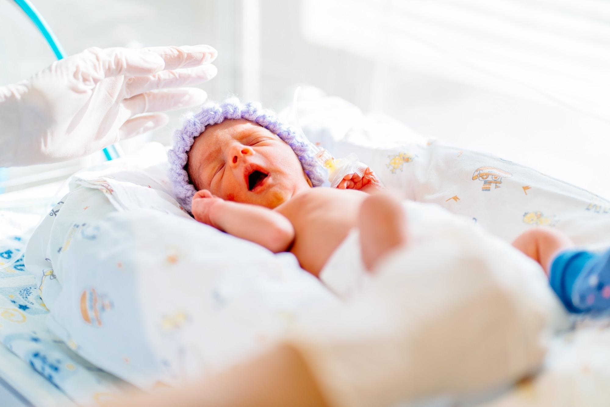 yawning premature born baby in intensive care unit