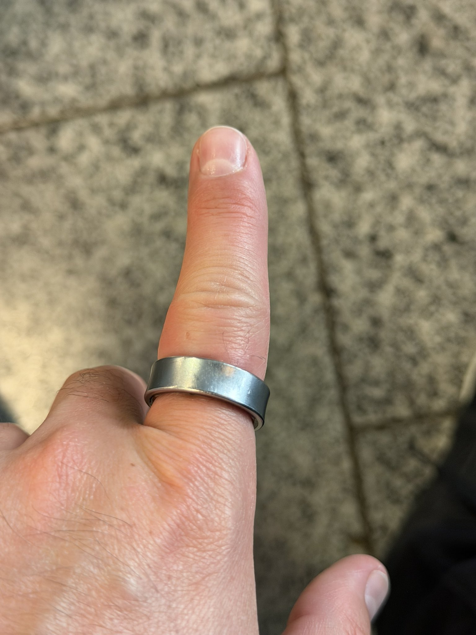 טבעת גלקסי של סמסונג נפוחה על אצבעו של דניאל רוטר