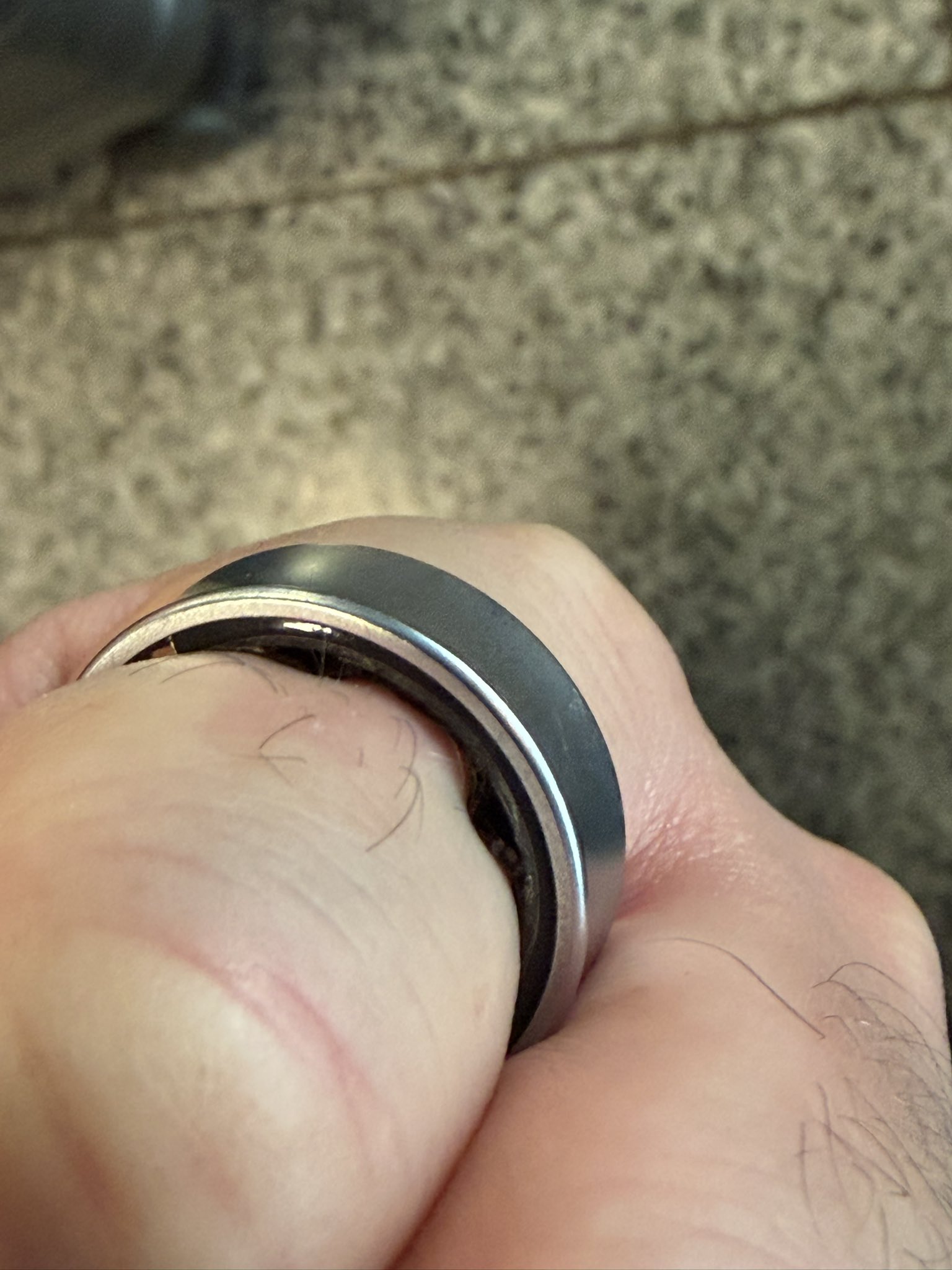 טבעת גלקסי של סמסונג נפוחה על אצבעו של דניאל רוטר