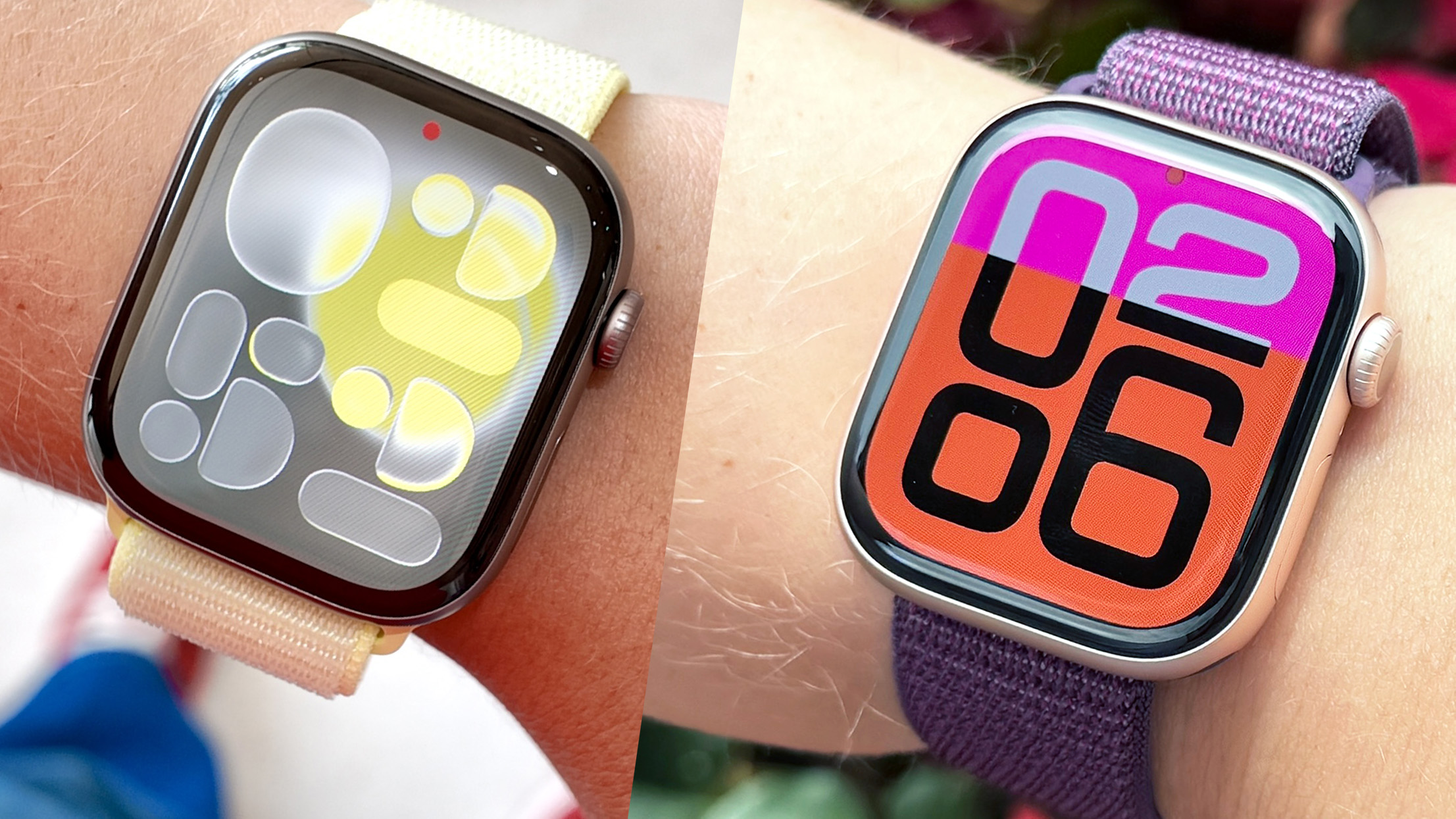Apple Watch Series 11 ו- Apple Watch Series 10