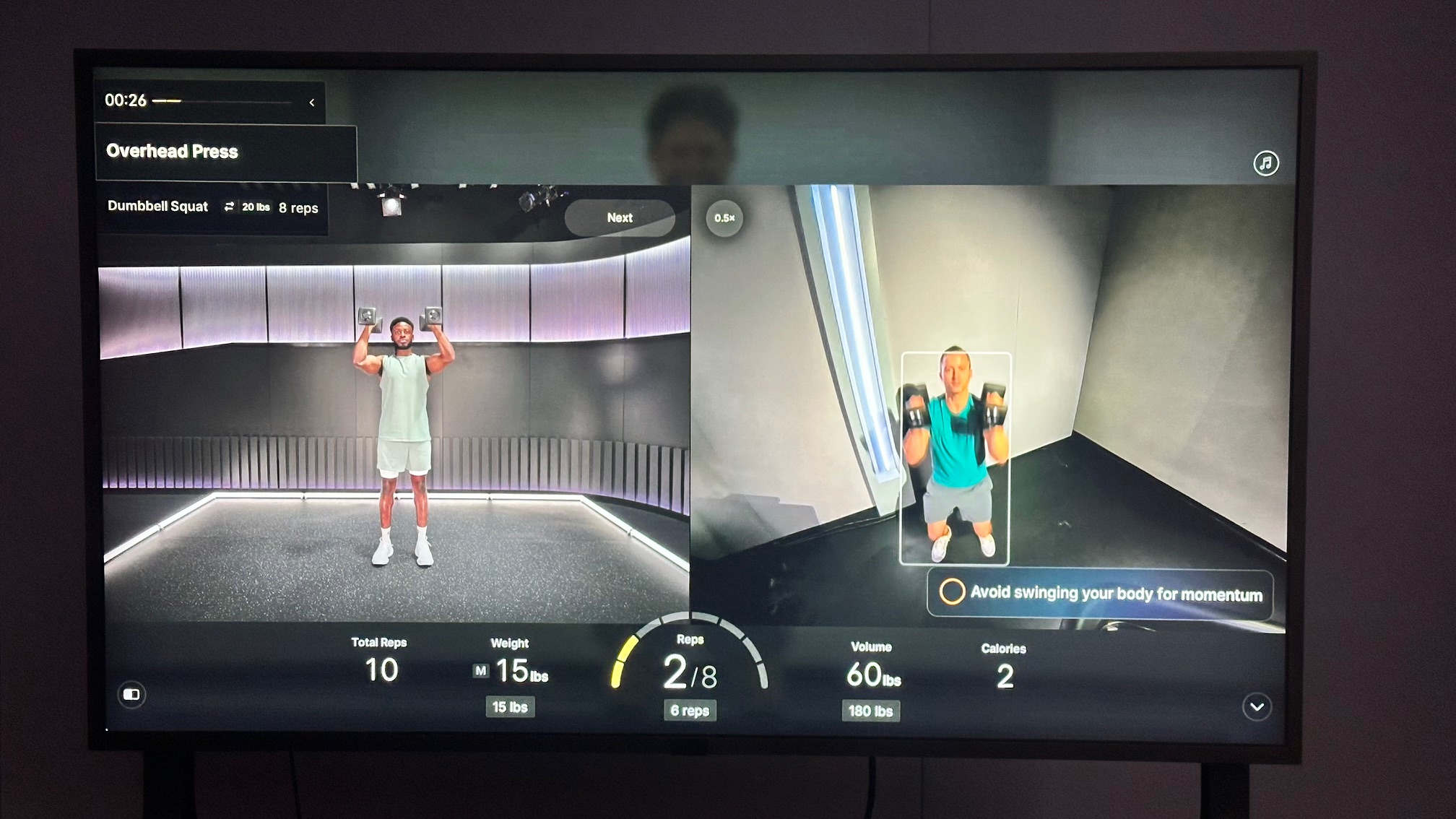 פלוטון מנת משכל