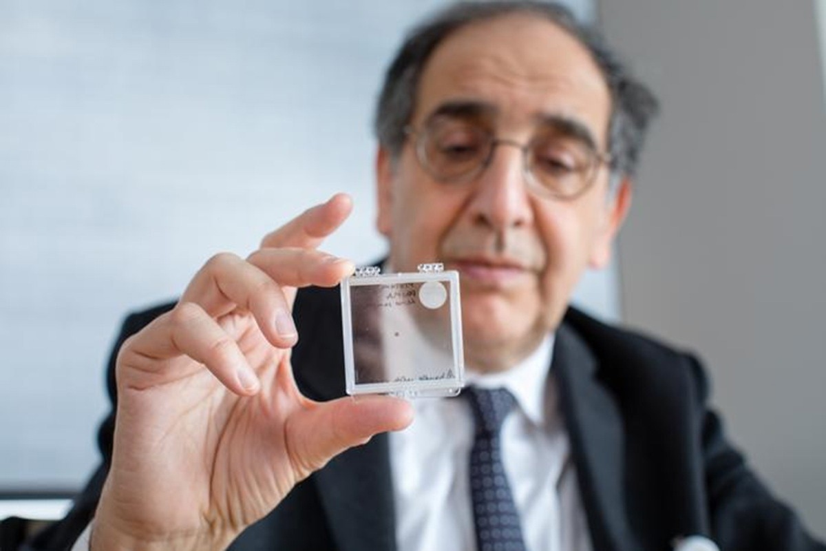 השתלת רשתית אלחוטית מחזירה את הראייה למטופלים שעיוורו על ידי ניוון מקולרי מתקדם