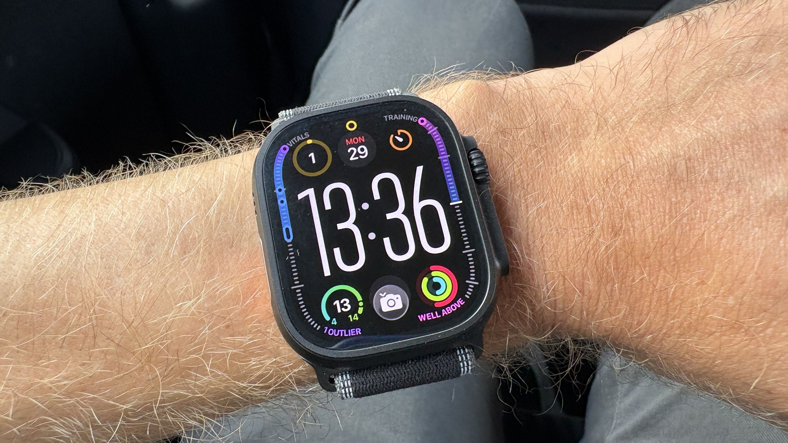Apple Watch עומד בפני איסור לאחר אובדן התביעה של Masimo - מה שאתה צריך לדעת