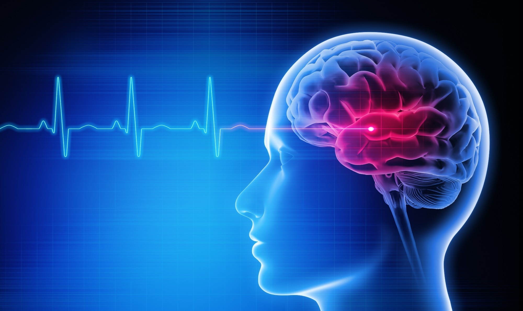 הקלטות מוח חושפות מדוע התשוקה לאוכל חוזרת למרות טירזפטיד