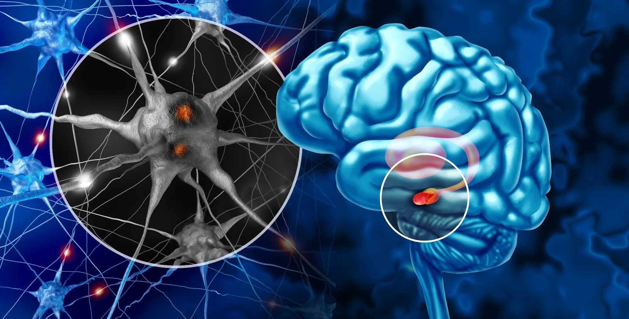 Study: Sleep and Parkinson’s disease: a population-based study from the CHARLS cohort.