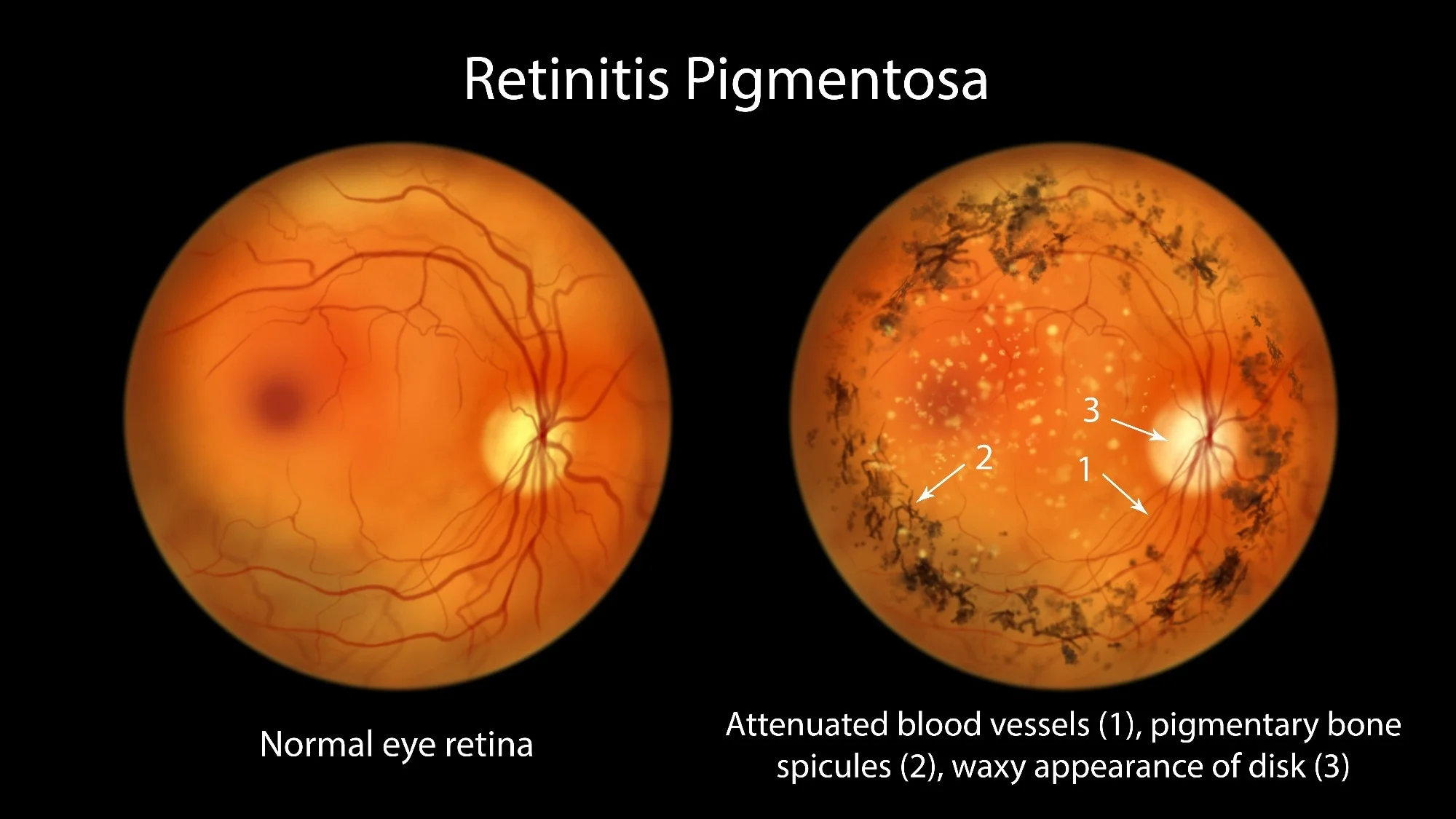 Study: Optogenetic Therapy for Restoring Aspects of Visual Function. Image Credit: Kateryna Kon / Shutterstock