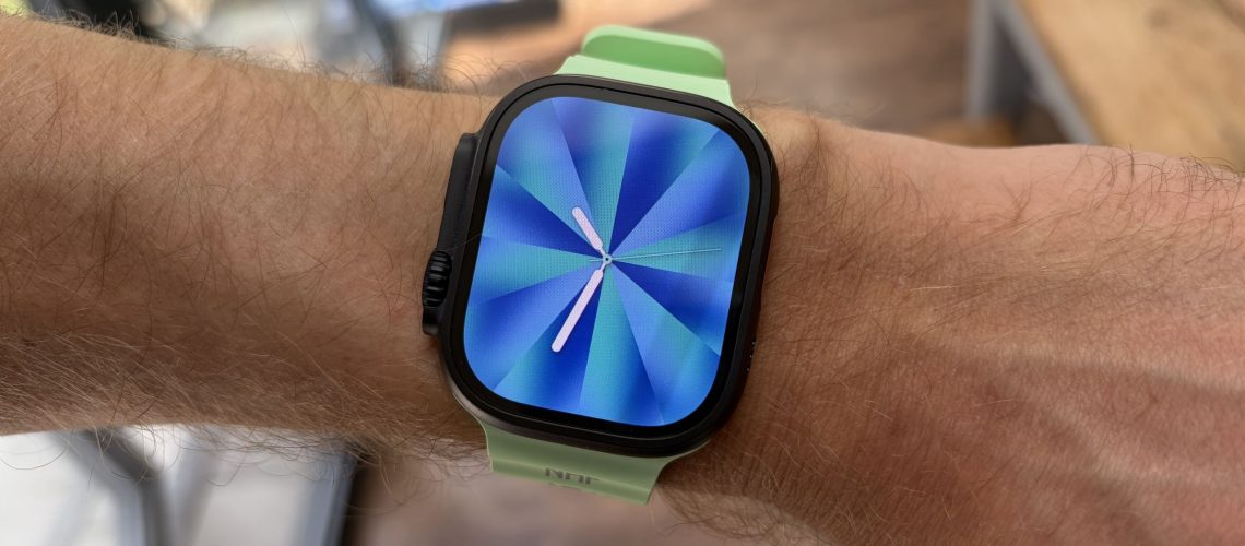 Apple Watch עשוי לעולם לא לקבל יכולות Touch ID לטובת תכונות אחרות