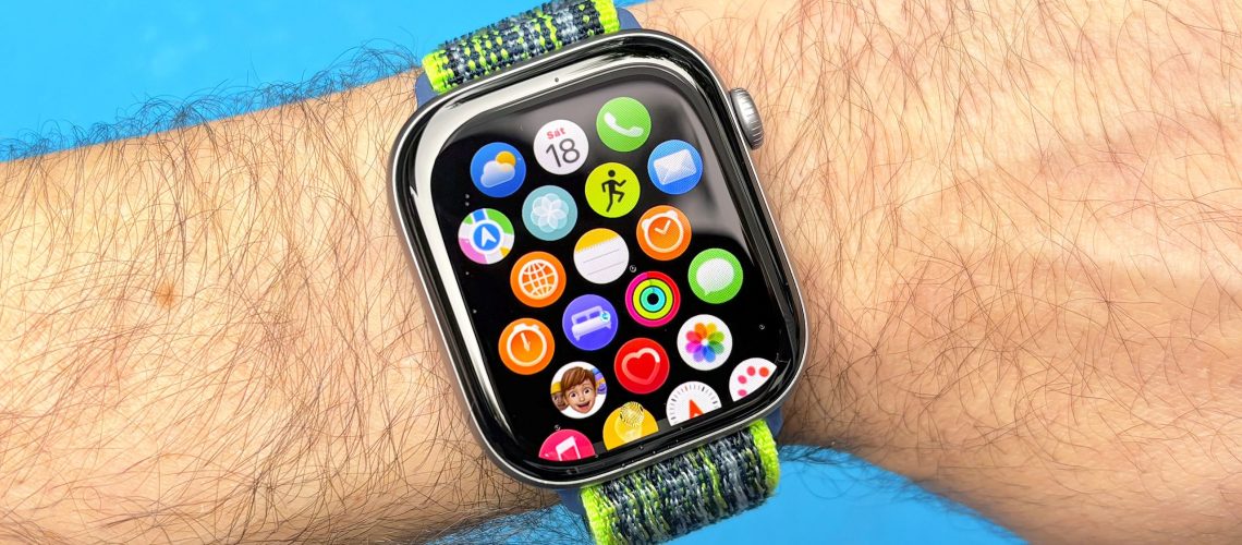Apple Watch Series 12 לעומת 11: השדרוגים הגדולים ביותר לפי השמועות