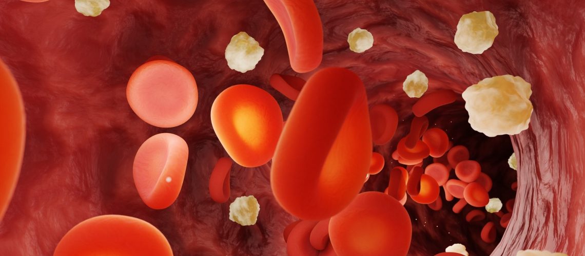 Study: Epigenetic biomarkers predict macrovascular events in individuals with type 2 diabetes. Image Credit: Dragon Claws / Shutterstock