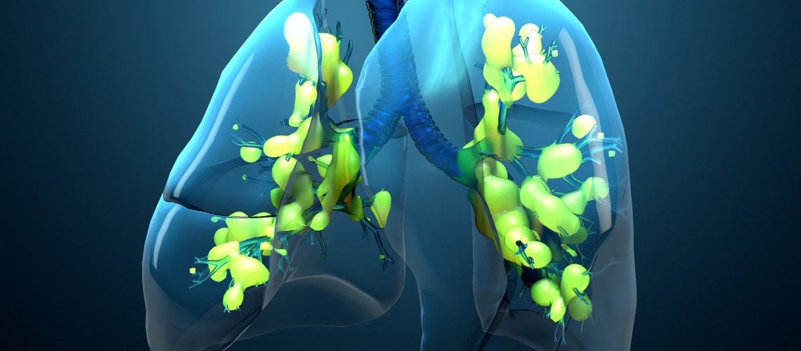 Review: Artificial intelligence and machine learning in acute respiratory distress syndrome management: recent advances. Image Credit: Design_Cells / Shutterstock