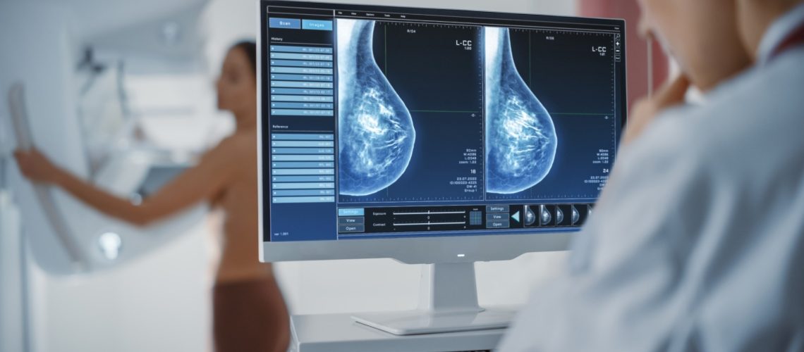 Computer Screen in Hospital Radiology Room: Beautiful Multiethnic Adult Woman Standing Topless Undergoing Mammography Screening Procedure.