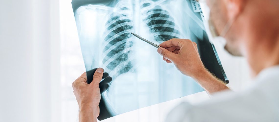 Study: Potential of GPT-4 for Detecting Errors in Radiology Reports: Implications for Reporting Accuracy. Image Credit: Soloviova Liudmyla / Shutterstock