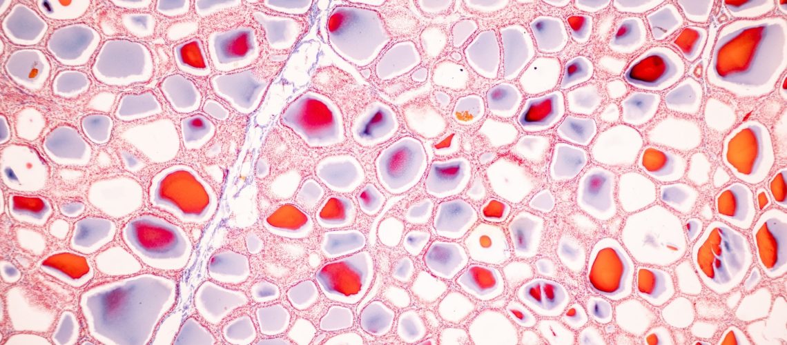 Cells in the thyroid gland