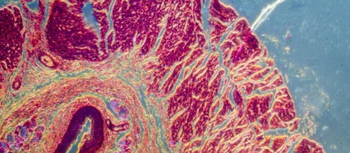 NIAID מעניק מענקים עבור 10 פרויקטים לשיפור כלי אבחון עבור עגבת