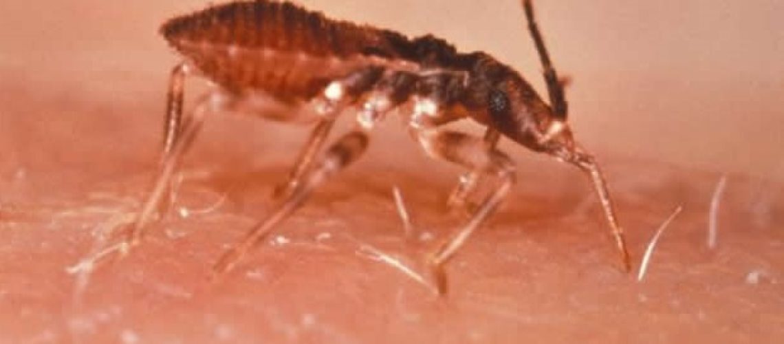 Sacubitril/Valsartan מראה תועלת על פני אנלפריל באי ספיקת לב הנגרמת על ידי מחלת צ'אגאס