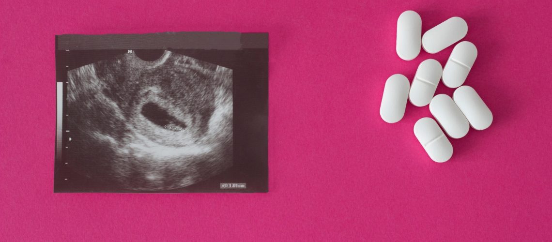 Study: First-Trimester Antibiotic Use for Urinary Tract Infection and Risk of Congenital Malformations. Image Credit: HenadziPechan / Shutterstock