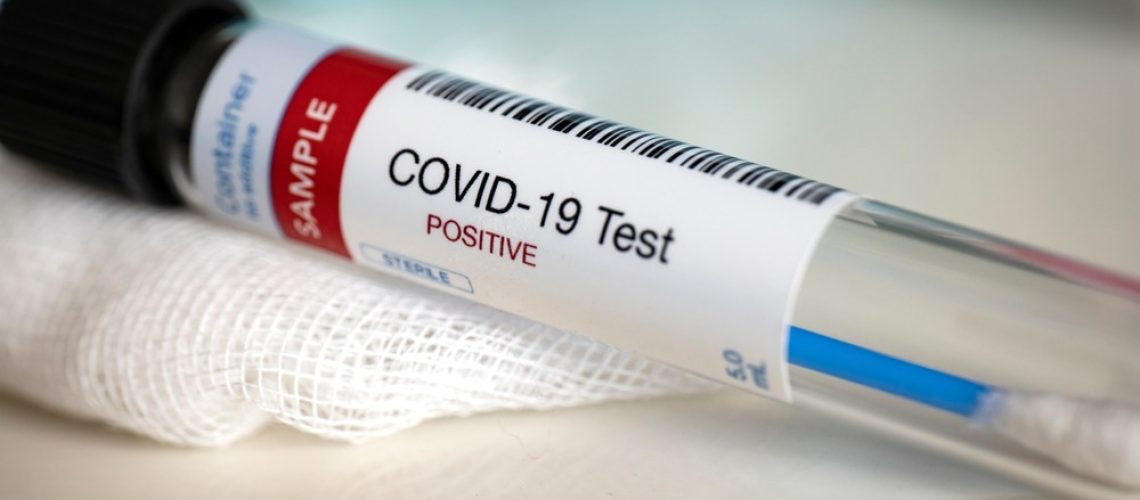 Study: Pseudo-Luciferase Activity of the SARS-CoV-2 Spike Protein for Cypridina Luciferin. Image Credit: Myriam B/Shutterstock.com