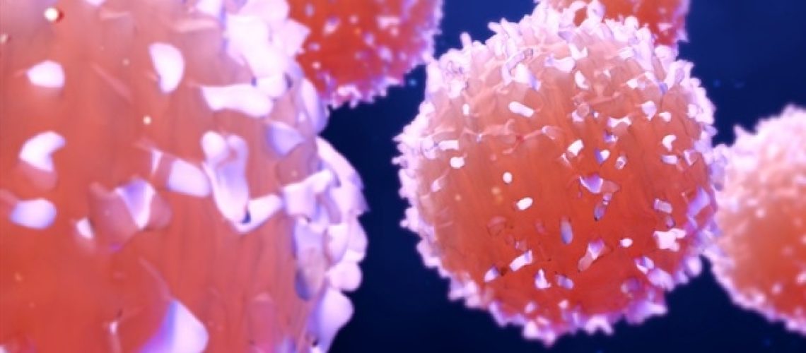 אבן דרך בטיפול בלימפוציטים חודרים לגידול במלנומה מתקדמת