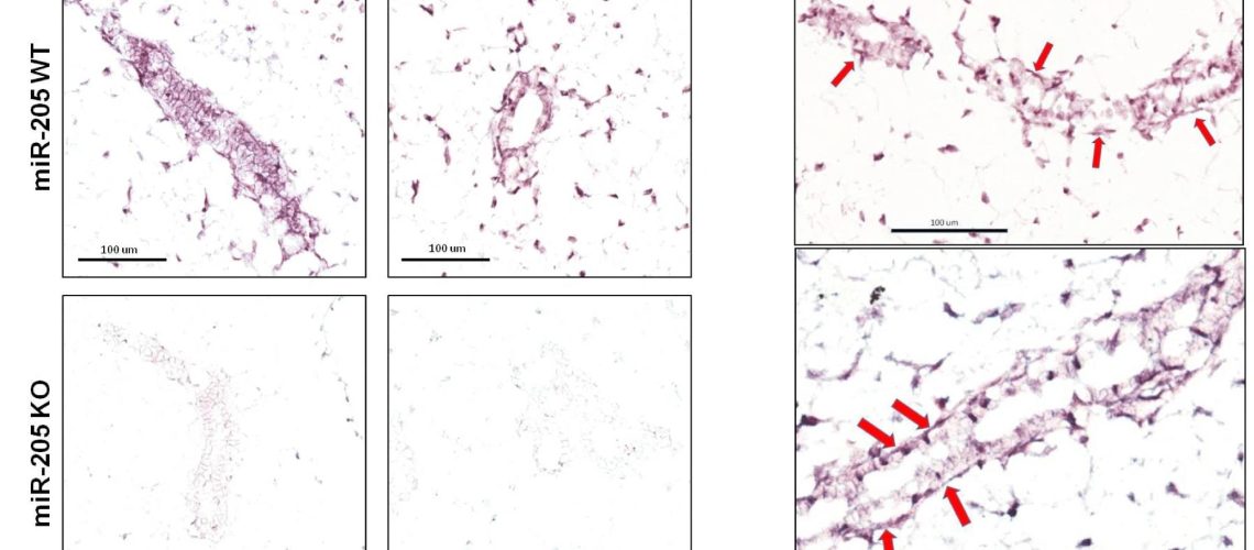אובדן גנטי של miR-205 מגביר את התפתחות בלוטת החלב בעכברים, חושף תובנות חדשות לגבי דיכוי סרטן השד