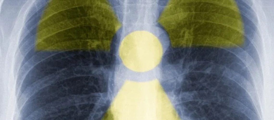 אוניברסיטת מיזורי משיקה ניסוי קליני רדיו-פרמצבטי ראשון בקמפוס