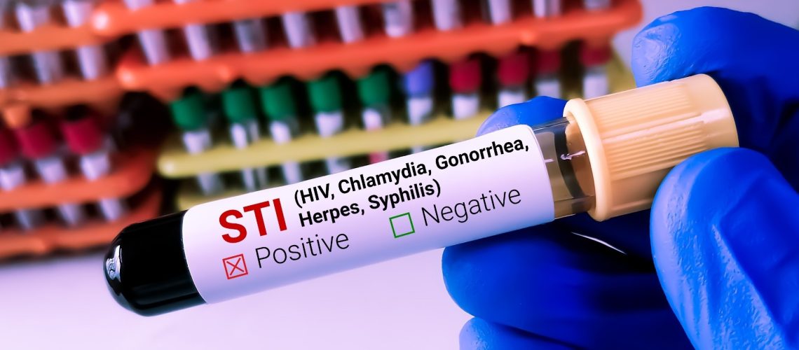 Lab Technologist holds Blood sample for STI