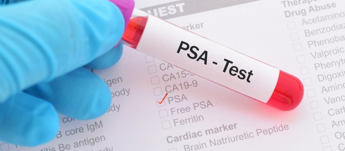 Study: Prostate Cancer Screening Uptake in Transgender Women. Image Credit: Jarun Ontakrai/Shutterstock.com
