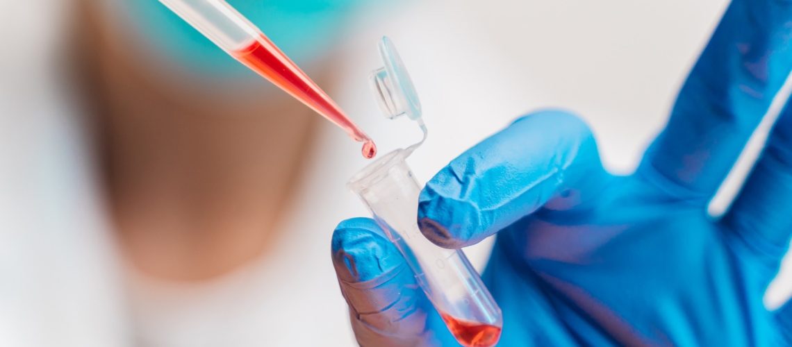 Study: Platform-independent estimation of human physiological time from single blood samples. Image Credit: Nuva Frames / Shutterstock