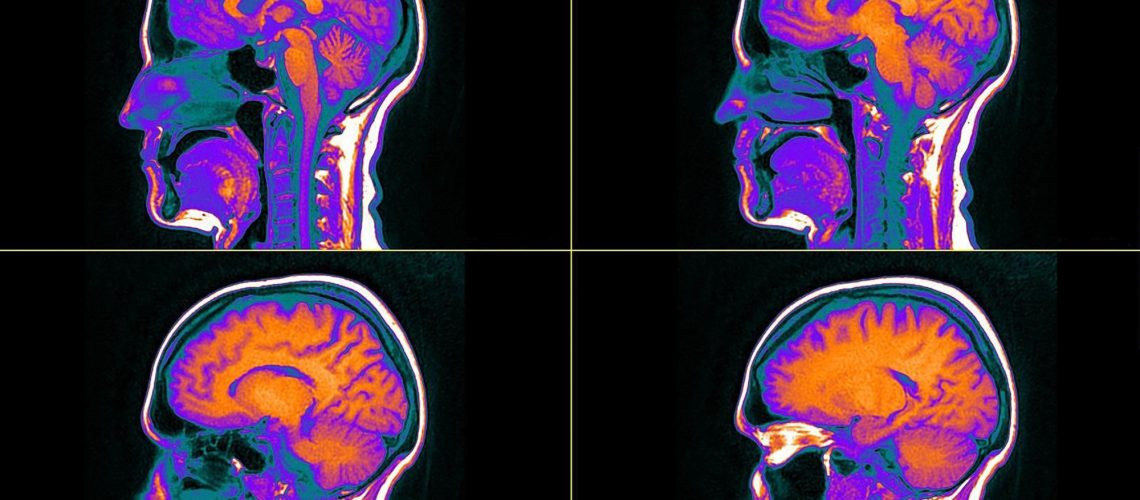 אמונות ניקוטין מעוררות תגובות מינון-תגובה במוח האנושי