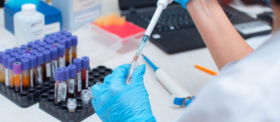 ​​​​​​​Study: Vaccination induces broadly neutralizing antibody precursors to HIV gp41. Image Credit: Salov Evgeniy/Shutterstock.com