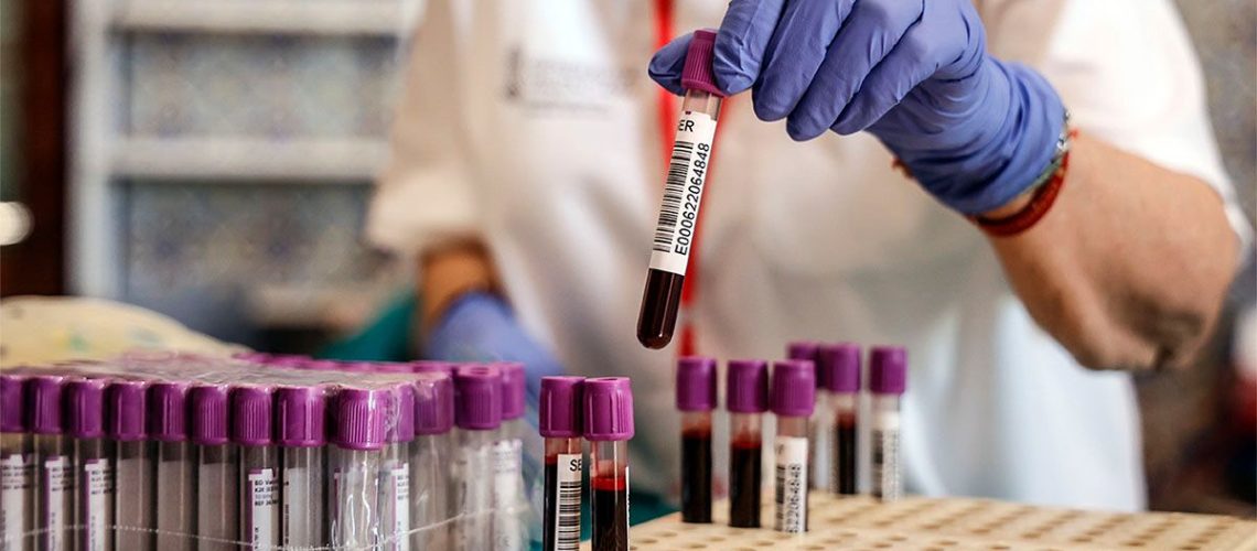 בדיקת דם מראה דיוק של 90% בזיהוי מחלת האלצהיימר