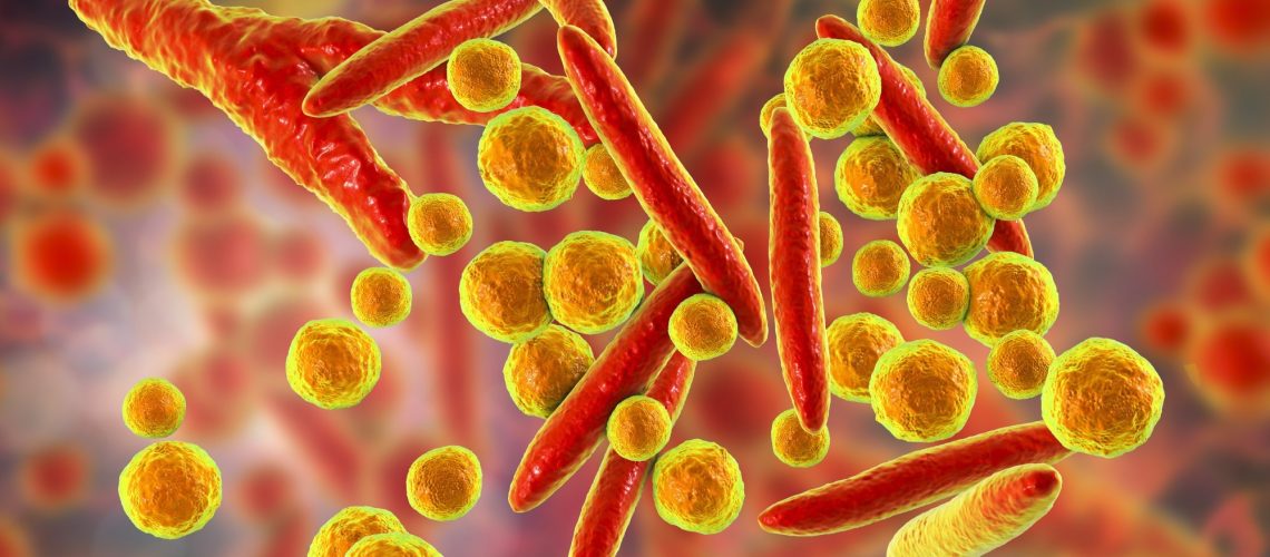 Study: Increased incidence of Mycoplasma pneumoniae infections and hospital admissions in the Netherlands, November to December 2023. Image Credit: Kateryna Kon / Shutterstock