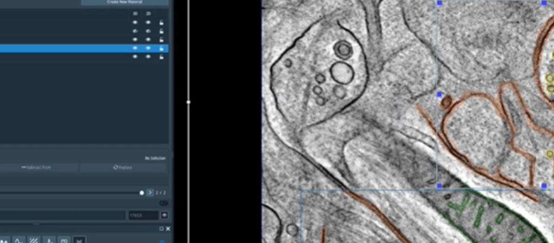 גלה את גירסת התוכנה של Amira 2024.2