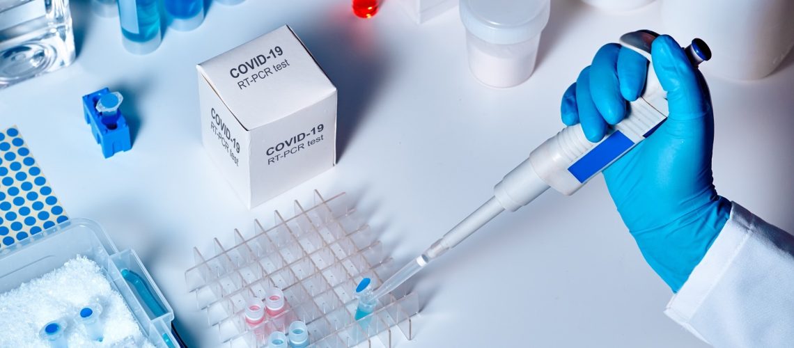 Study: RT-PCR genotyping assays to identify SARS-CoV-2 variants in England in 2021: a design and retrospective evaluation study, Image Credit: tilialucida / Shutterstock.com